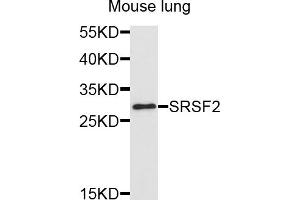 Western blot analysis of extracts of mouse lung, using SRSF2 antibody (ABIN5995581) at 1/1000 dilution. (SRSF2 antibody)