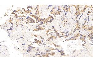 Immunohistochemistry (IHC) image for anti-Cyclin-Dependent Kinase Inhibitor 1A (p21, Cip1) (CDKN1A) (AA 1-164) antibody (ABIN7439048)