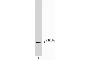 Western blot analysis of p21. (p21 antibody)