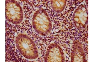 IHC image of ABIN7164994 diluted at 1:400 and staining in paraffin-embedded human appendix tissue performed on a Leica BondTM system. (PSMB9 antibody  (AA 21-219))
