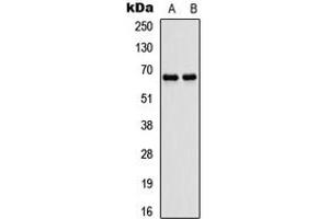 Western blot analysis of ATG16L1 expression in SHSY5Y (A), rat muscle (B) whole cell lysates. (ATG16L1 antibody  (Center))
