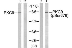 Western blot analysis of extract from Jurkat cells untreated or treated with PMA (1ng/ml, 5min), using PKCθ (Ab-676) antibody (E021289, Lane 1 and 2) and PKCθ (phospho- Ser676) antibody (E011297, Lane 3 and 4). (PKC theta antibody  (pSer676))