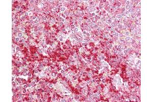 Anti-ETV5 antibody IHC of human spleen. (ETV5 antibody  (N-Term))
