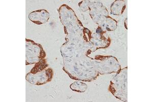 Immunohistochemistry of paraffin-embedded human placenta using S antibody (ABIN6132970, ABIN6147387, ABIN6147388 and ABIN6215904) at dilution of 1:100 (40x lens). (SARS2 antibody  (AA 289-518))