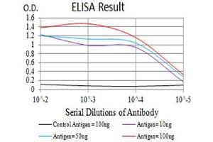 Black line: Control Antigen (100 ng),Purple line: Antigen (10 ng), Blue line: Antigen (50 ng), Red line:Antigen (100 ng) (P2RY4 antibody)