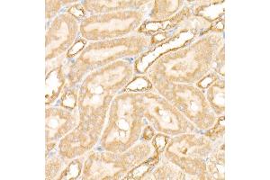 Immunohistochemistry of paraffin-embedded rat kidney using PFKP antibody (ABIN7269309) at dilution of 1:100 (40x lens). (PFKP antibody)