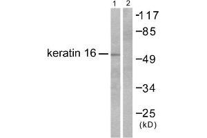 Western Blotting (WB) image for anti-Keratin 16 (KRT16) (C-Term) antibody (ABIN1848628) (KRT16 antibody  (C-Term))