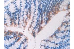 Detection of FBLN4 in Mouse Colon Tissue using Polyclonal Antibody to Fibulin 4 (FBLN4) (FBLN4 antibody  (AA 182-431))