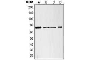 Western blot analysis of c-RAF expression in A431 (A), HeLa (B), RAW264. (RAF1 antibody  (Center))