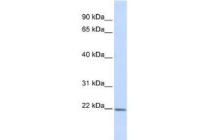 WB Suggested Anti-ZFAND5 Antibody Titration:  0. (ZFAND5 antibody  (Middle Region))