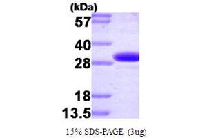SDS-PAGE (SDS) image for Carbonic Anhydrase II (CA2) (AA 1-260) protein (ABIN667740)