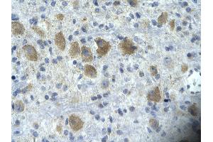 Rabbit Anti-TAF15 Antibody       Paraffin Embedded Tissue:  Human neural cell   Cellular Data:  Epithelial cells of renal tubule  Antibody Concentration:   4. (TAF15 antibody  (N-Term))