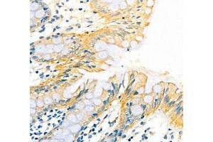 Immunohistochemistry (Paraffin-embedded Sections) (IHC (p)) image for anti-ATPase, H+/K+ Transporting, Nongastric, alpha Polypeptide (ATP12A) antibody (ABIN7073160)