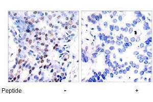 Image no. 2 for anti-Jun Proto-Oncogene (JUN) (AA 89-93) antibody (ABIN197129) (C-JUN antibody  (AA 89-93))