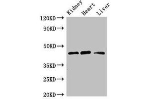 Western Blot Positive WB detected in: Mouse kidney tissue, Rat heart tissue, Rat liver tissue All lanes: WTAP antibody at 3 μg/mL Secondary Goat polyclonal to rabbit IgG at 1/50000 dilution Predicted band size: 45, 18 kDa Observed band size: 45 kDa (WTAP antibody  (AA 1-151))
