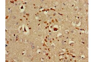 Immunohistochemistry of paraffin-embedded human brain tissue using ABIN7142174 at dilution of 1:100 (OAS3 antibody  (AA 424-565))