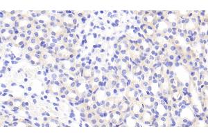 Immunohistochemistry (IHC) image for anti-ADAM Metallopeptidase with Thrombospondin Type 1 Motif, 2 (Adamts2) (AA 855-1030) antibody (ABIN7440095)