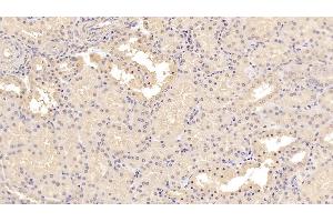 Detection of MSRA in Human Kidney Tissue using Monoclonal Antibody to Methionine Sulfoxide Reductase A (MSRA) (MSRA antibody  (AA 27-235))