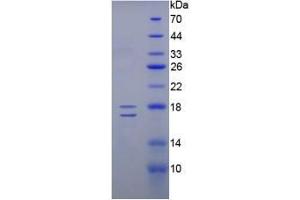 SDS-PAGE analysis of Human Inhibin beta E Protein.