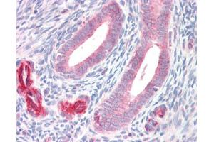 IHC-P Image ADAM33 antibody [C2C3], C-term detects ADAM33 protein at cytoplasm on human placenta by immunohistochemical analysis. (ADAM33 antibody  (C-Term))