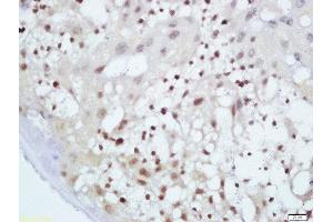 Formalin-fixed and paraffin embedded mouse placenta labeled with Anti-GnRHR Polyclonal Antibody, Unconjugated  at 1:200 followed by conjugation to the secondary antibody and DAB staining (MAF antibody  (AA 341-403))