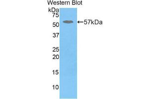 Western Blotting (WB) image for anti-Glucosidase, Beta, Acid (GBA) (AA 248-508) antibody (ABIN3205107) (GBA antibody  (AA 248-508))