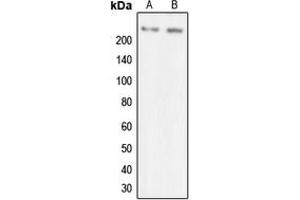 Western blot analysis of MYO7A expression in SKOVCAR (A), HEK293T (B) whole cell lysates. (Myosin VIIA antibody  (Center))