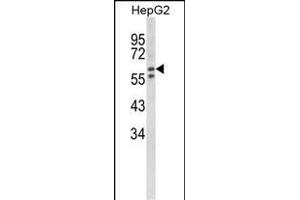 Western blot analysis of HEXA Antibody (Center) (ABIN652263 and ABIN2841133) in HepG2 cell line lysates (35 μg/lane). (Hexosaminidase A antibody  (AA 315-343))