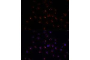 Immunofluorescence analysis of C6 cells using METTL16 antibody (ABIN7268501) at dilution of 1:100. (METTL16 antibody  (AA 263-562))