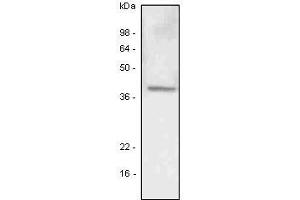 A549 (lung carcinoma) cell lysate was resolved by SDS-PAGE, transferred to PVDF membrane and probed with anti-human LYVE-1 antibody (1:500). (LYVE1 antibody  (AA 25-235))