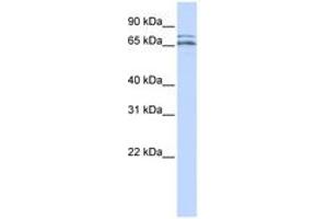 Image no. 1 for anti-Calcium Channel, Voltage-Dependent, beta 2 Subunit (CACNB2) (AA 396-445) antibody (ABIN6742591)