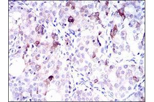 Immunohistochemistry (IHC) image for anti-Solute Carrier Family 27 (Fatty Acid Transporter), Member 5 (SLC27A5) (AA 508-570) antibody (ABIN1845743) (SLC27A5 antibody  (AA 508-570))