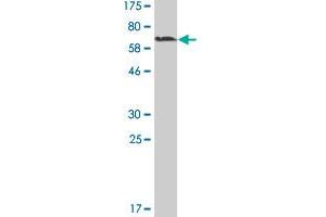 Western Blot detection against Immunogen (60. (MAGEA11 antibody  (AA 1-319))
