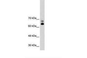 Image no. 2 for anti-Metastasis Associated 1 Family, Member 2 (MTA2) (C-Term) antibody (ABIN203470) (MTA2 antibody  (C-Term))
