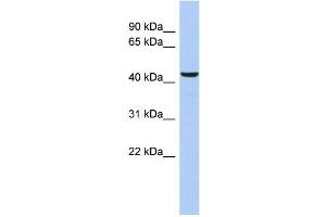 WB Suggested Anti-DFFB Antibody Titration: 0. (DFFB antibody  (Middle Region))