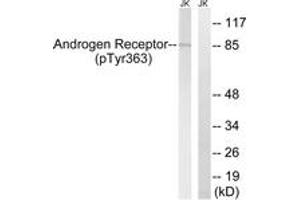Western blot analysis of extracts from Jurkat cells treated with UV 15', using Androgen Receptor (Phospho-Tyr363) Antibody. (Androgen Receptor antibody  (pTyr363))