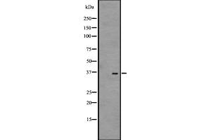 Western blot analysis of GPR35 expression in A431 whole cell lysate ,The lane on the left is treated with the antigen-specific peptide. (GPR35 antibody  (Internal Region))