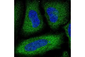 Immunofluorescent staining of HeLa cells with PDE3A polyclonal antibody  (Green) shows localization to cytosol. (PDE3A antibody)