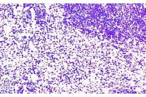 Immunohistochemistry (IHC) image for anti-Chemokine (C-C Motif) Receptor 7 (CCR7) antibody (ABIN2478988) (CCR7 antibody)