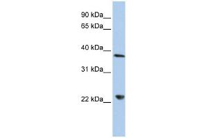 DDX25 antibody used at 1 ug/ml to detect target protein.