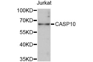 Western blot analysis of extracts of Jurkat cells, using CASP10 antibody (ABIN5997362) at 1:3000 dilution. (Caspase 10 antibody)