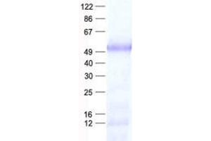 Validation with Western Blot
