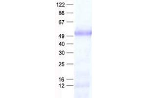 Validation with Western Blot (LHX2 Protein (His tag))