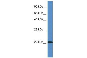 Western Blot showing RPL14 antibody used at a concentration of 1 ug/ml against Fetal Kidney Lysate (RPL14 antibody  (C-Term))