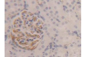 Used in DAB staining on fromalin fixed paraffin-embedded Liver tissue (Fibrinogen beta Chain antibody  (AA 33-479))