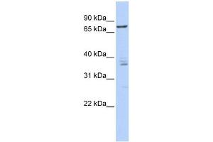 CSTF3 antibody used at 1 ug/ml to detect target protein. (CSTF3 antibody  (Middle Region))
