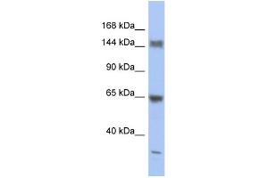 WB Suggested Anti-ATXN2 Antibody Titration:  0. (Ataxin 2 antibody  (Middle Region))
