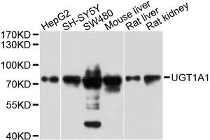 Western blot analysis of extracts of various cell lines, using μgT1A1 antibody (ABIN5999142) at 1/1000 dilution.