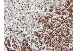 IHC-P Image Immunohistochemical analysis of paraffin-embedded MDA-MB-468 xenograft, using FPGT, antibody at 1:100 dilution. (FPGT antibody)