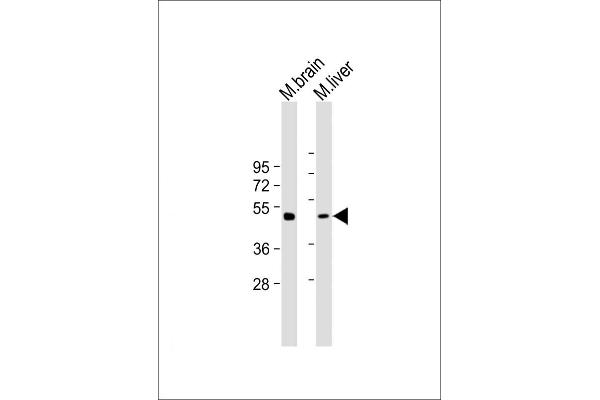 TUBG2 anticorps  (AA 400-434)